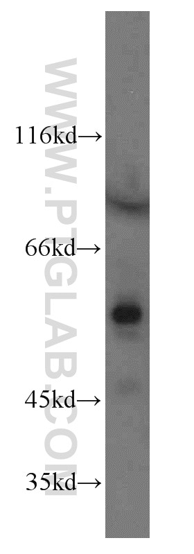 Western Blot (WB) analysis of K-562 cells using GCNF Polyclonal antibody (12712-1-AP)