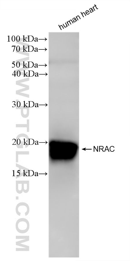 human heart tissue were subjected to SDS PAGE followed by western blot with 87528-1-RR (NRAC antibody) at dilution of 1:2000 incubated at room temperature for 1.5 hours. Western Blot (WB) analysis of human heart tissue using NRAC Recombinant monoclonal antibody (87528-1-RR)