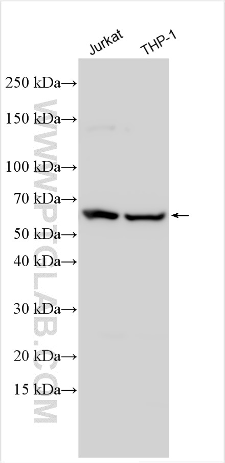 Western Blot (WB) analysis of various lysates using NRAMP1 Polyclonal antibody (32308-1-AP)