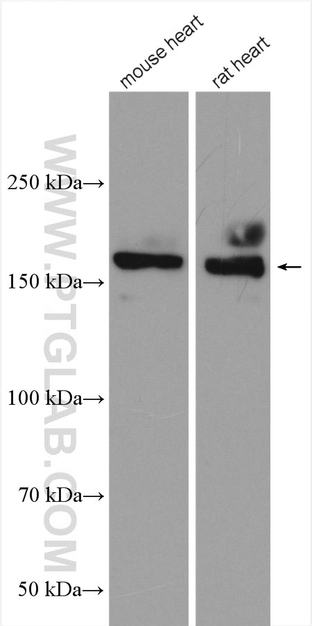 Western Blot (WB) analysis of various lysates using NRAP Polyclonal antibody (25977-1-AP)