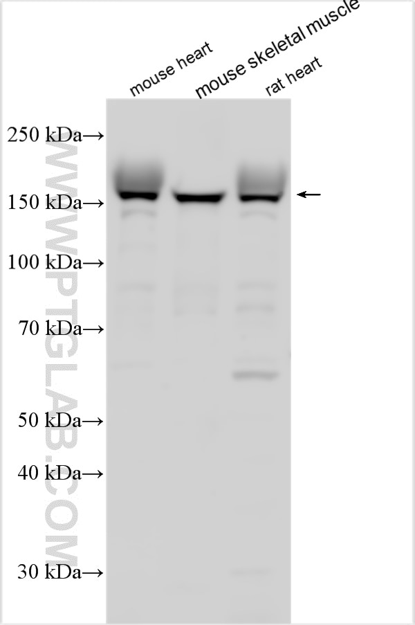 Western Blot (WB) analysis of various lysates using NRAP Polyclonal antibody (25977-1-AP)