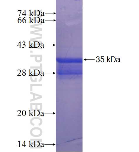 NRAP fusion protein Ag23254 SDS-PAGE