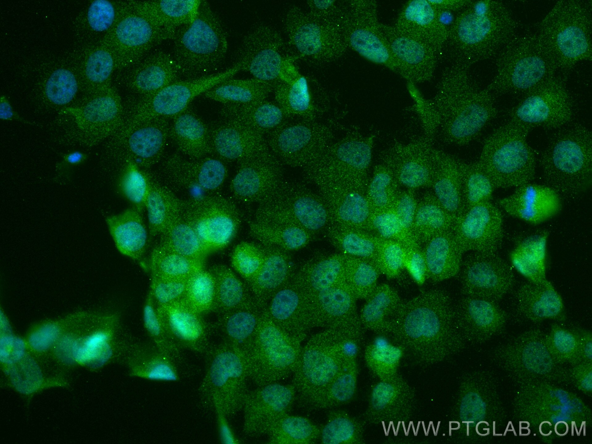 Immunofluorescence (IF) / fluorescent staining of A431 cells using NRARP Polyclonal antibody (14588-1-AP)