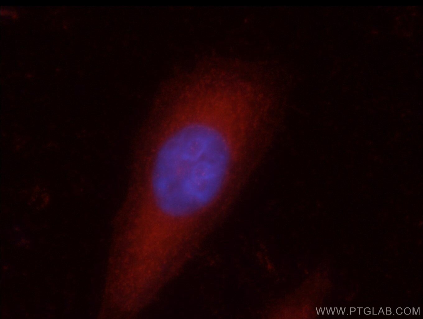 NRAS Polyclonal antibody