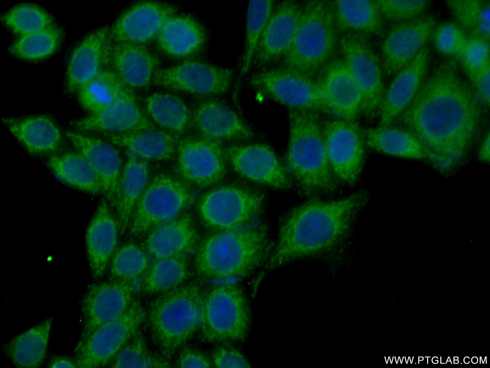 Immunofluorescence (IF) / fluorescent staining of HeLa cells using NRAS Polyclonal antibody (10724-1-AP)