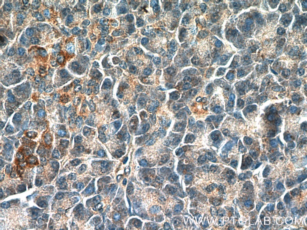 Immunohistochemistry (IHC) staining of human pancreas tissue using NRAS Polyclonal antibody (10724-1-AP)