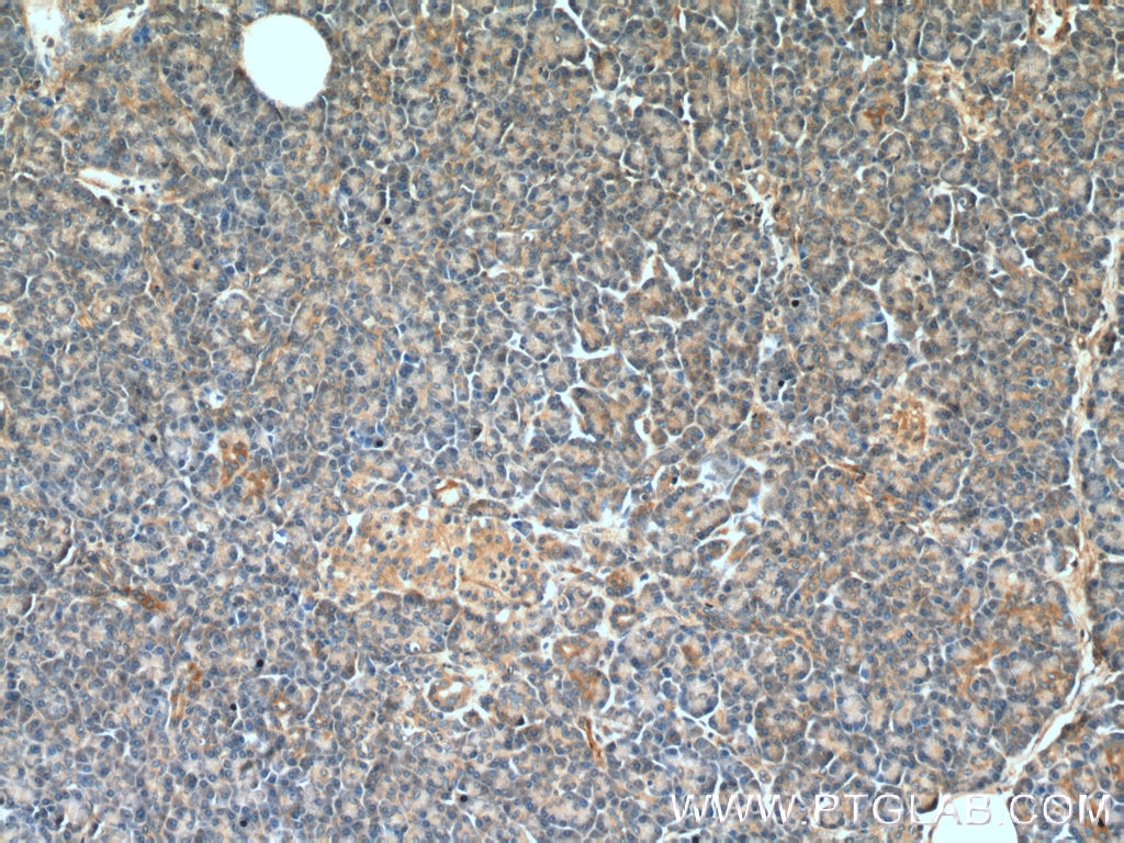 Immunohistochemistry (IHC) staining of human pancreas tissue using NRAS Polyclonal antibody (10724-1-AP)