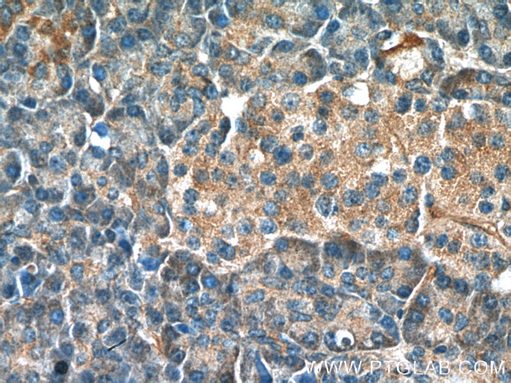 Immunohistochemistry (IHC) staining of human pancreas tissue using NRAS Polyclonal antibody (10724-1-AP)