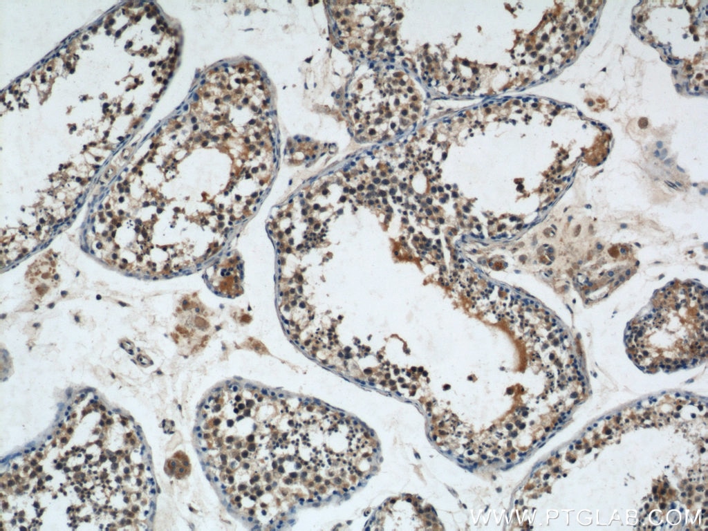 Immunohistochemistry (IHC) staining of human testis tissue using NRAS Polyclonal antibody (10724-1-AP)