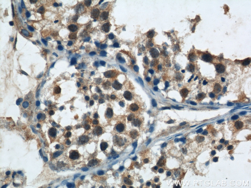 Immunohistochemistry (IHC) staining of human testis tissue using NRAS Polyclonal antibody (10724-1-AP)
