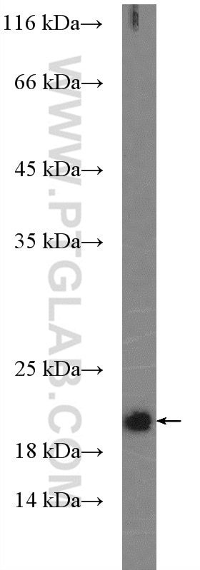 NRAS Polyclonal antibody