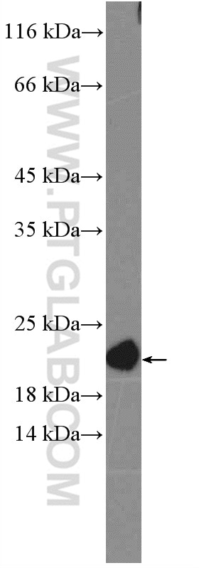 Western Blot (WB) analysis of C6 cells using NRAS Polyclonal antibody (10724-1-AP)