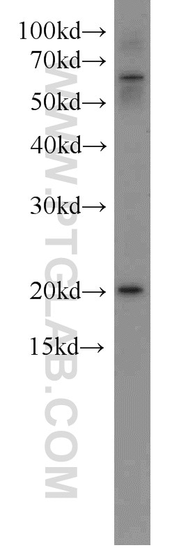 Western Blot (WB) analysis of Jurkat cells using NRAS Polyclonal antibody (10724-1-AP)