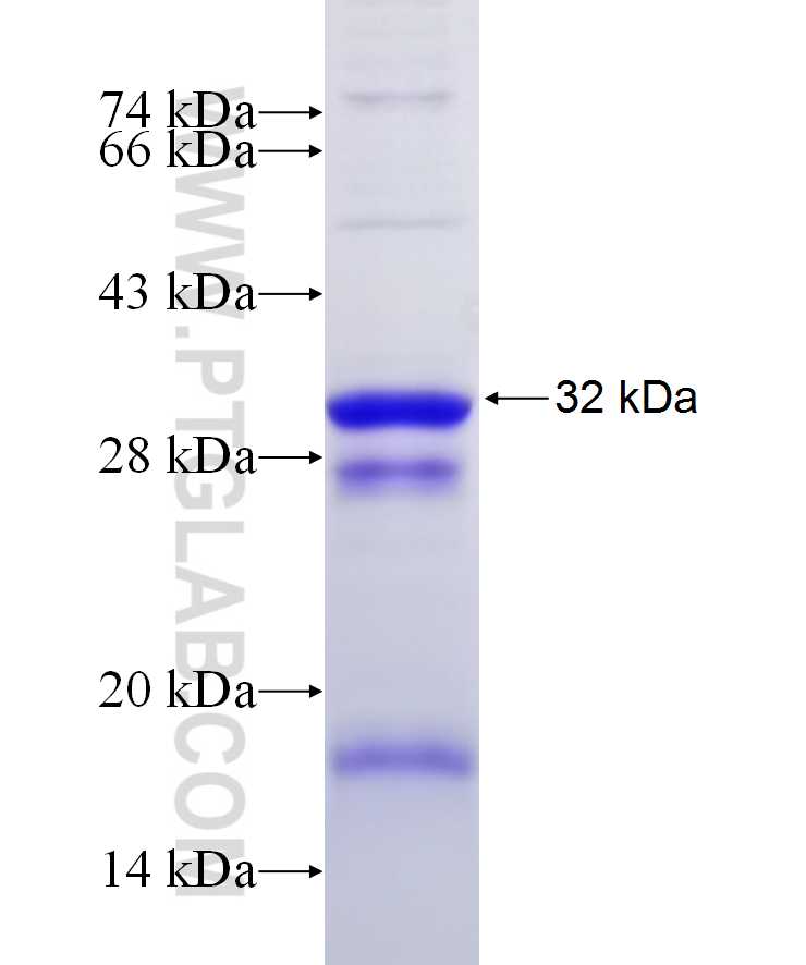NRAS fusion protein Ag29746 SDS-PAGE