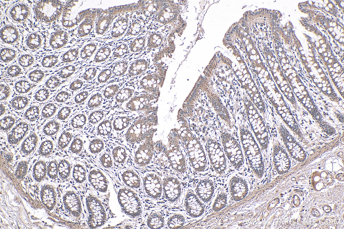 Immunohistochemistry (IHC) staining of human colon tissue using NRAS-Specific Polyclonal antibody (18296-1-AP)