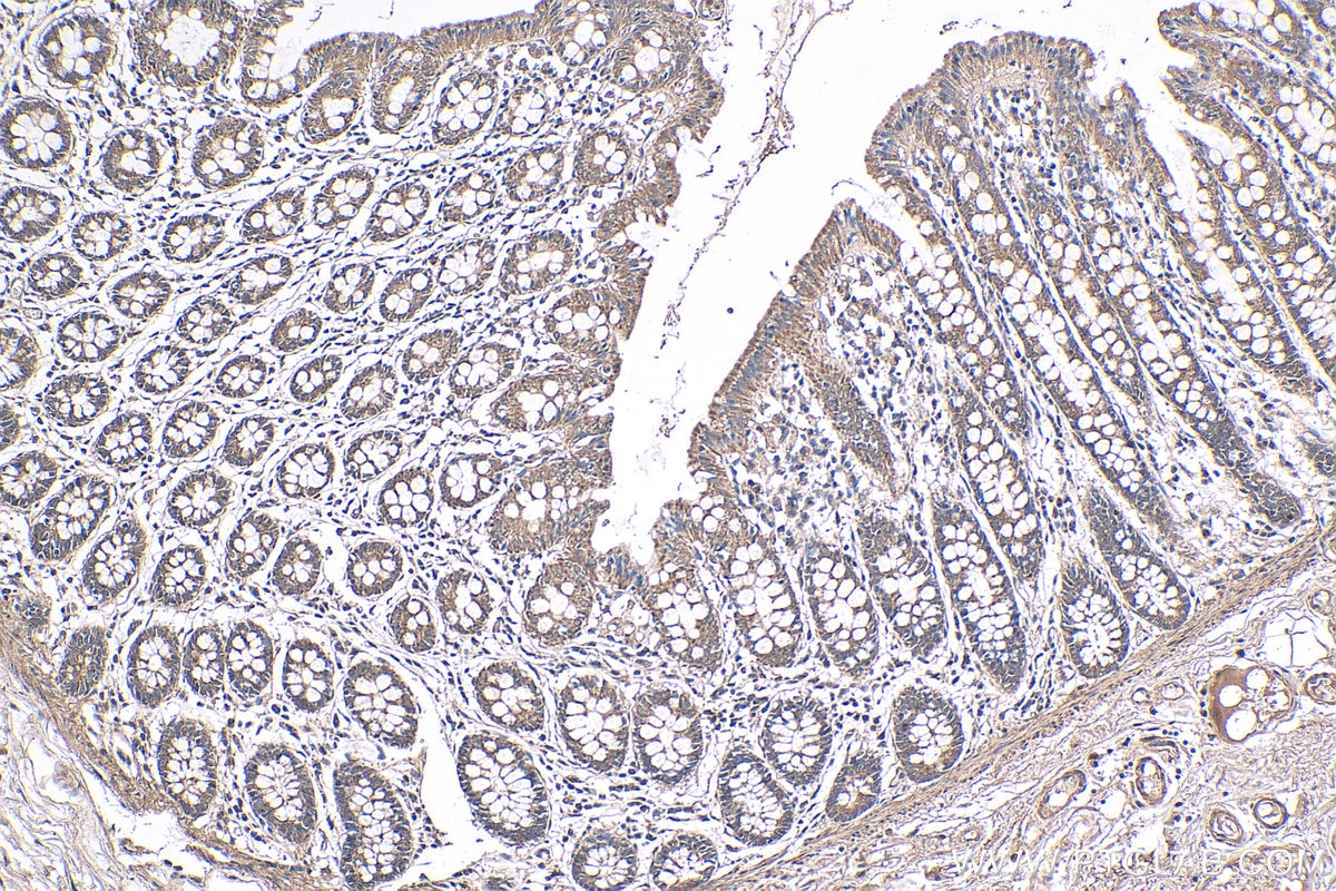 IHC staining of human colon using 18296-1-AP