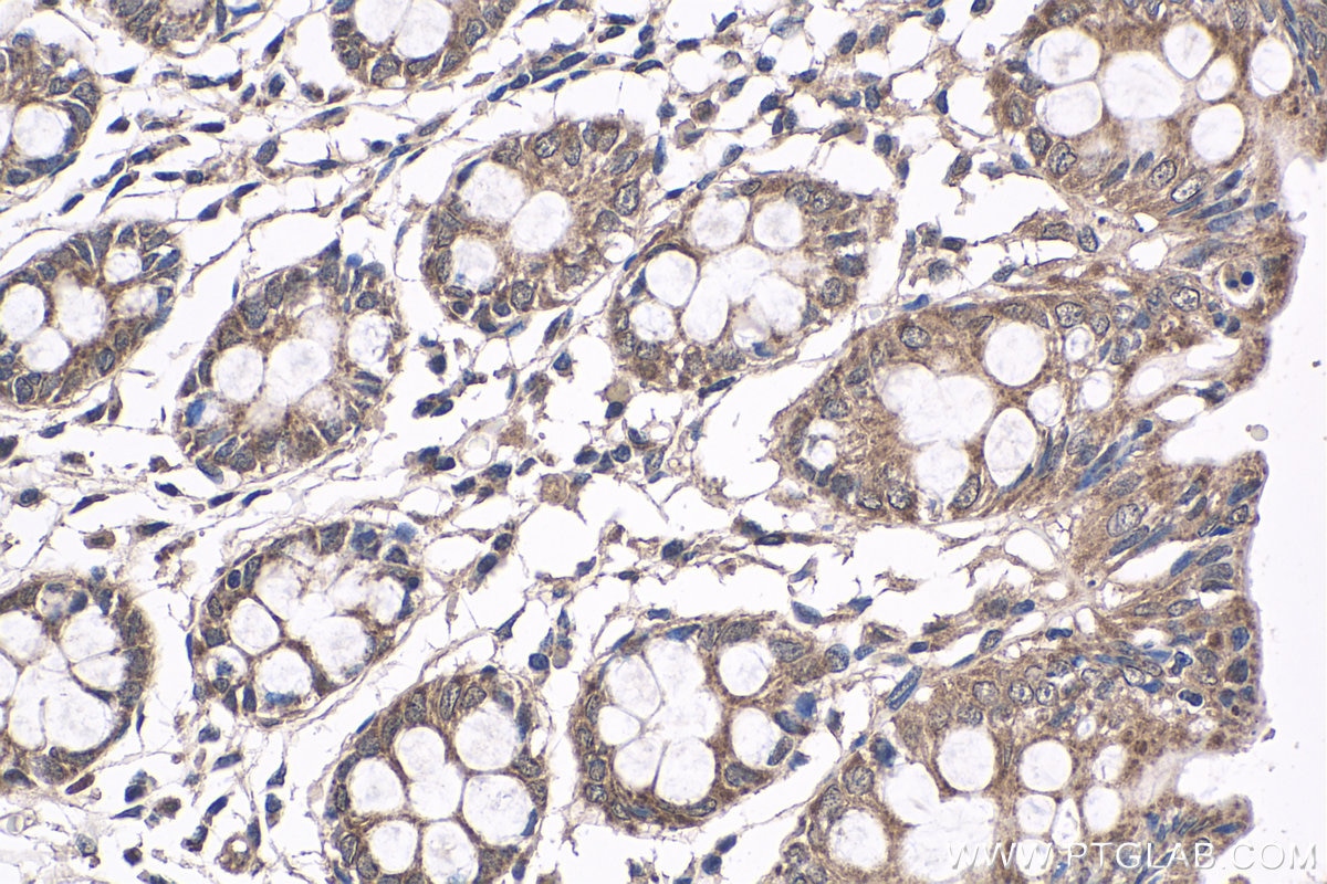 Immunohistochemistry (IHC) staining of human colon tissue using NRAS-Specific Polyclonal antibody (18296-1-AP)