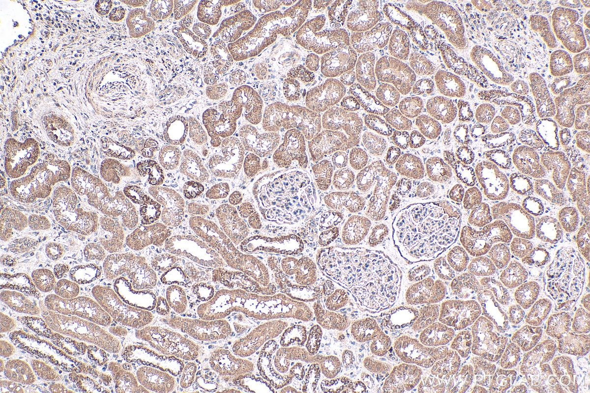 Immunohistochemistry (IHC) staining of human kidney tissue using NRAS-Specific Polyclonal antibody (18296-1-AP)