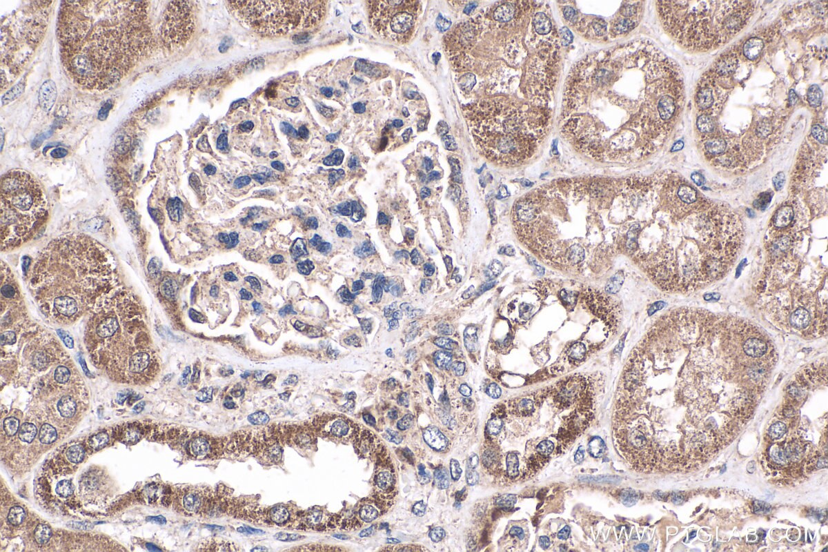 IHC staining of human kidney using 18296-1-AP