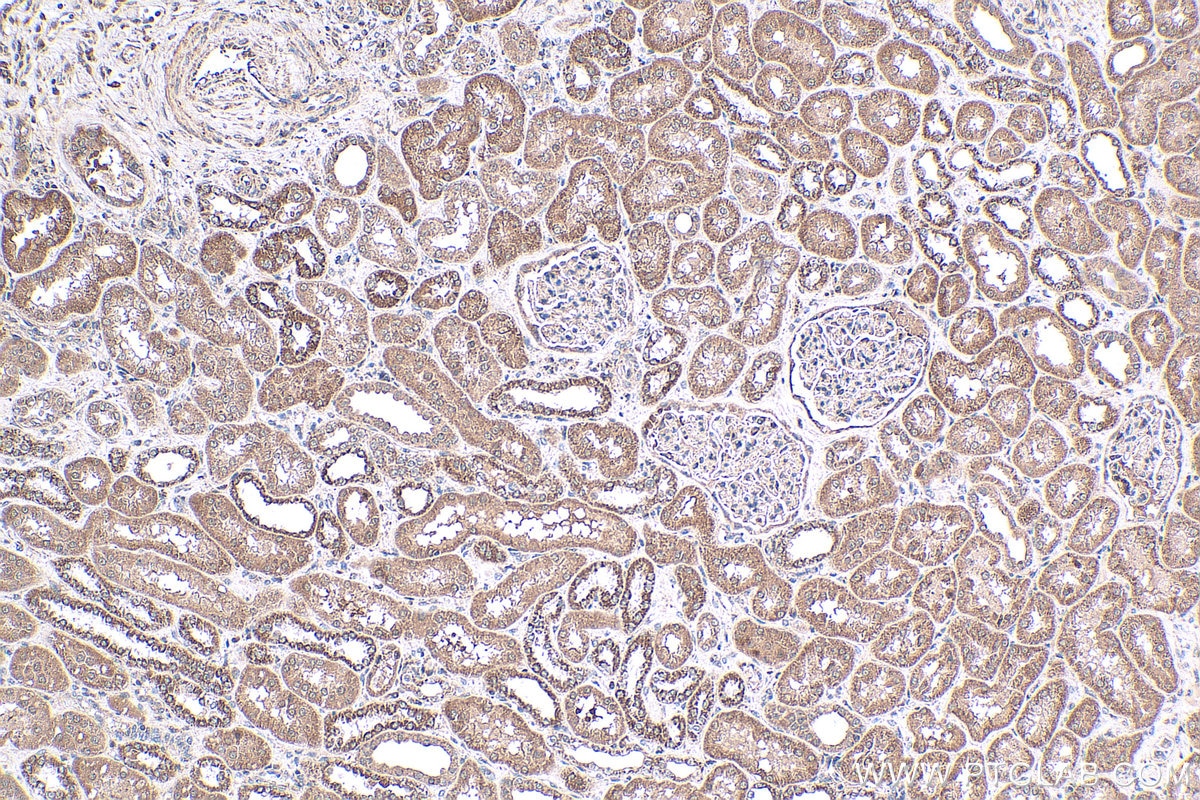 Immunohistochemistry (IHC) staining of human kidney tissue using NRAS-Specific Polyclonal antibody (18296-1-AP)