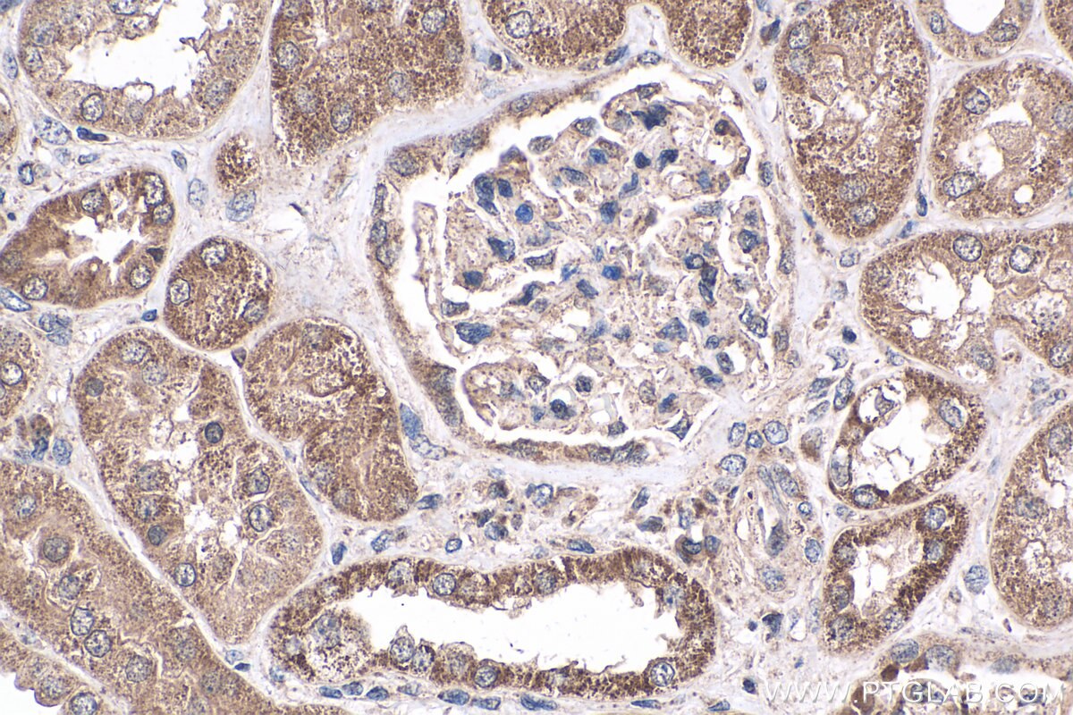 IHC staining of human kidney using 18296-1-AP