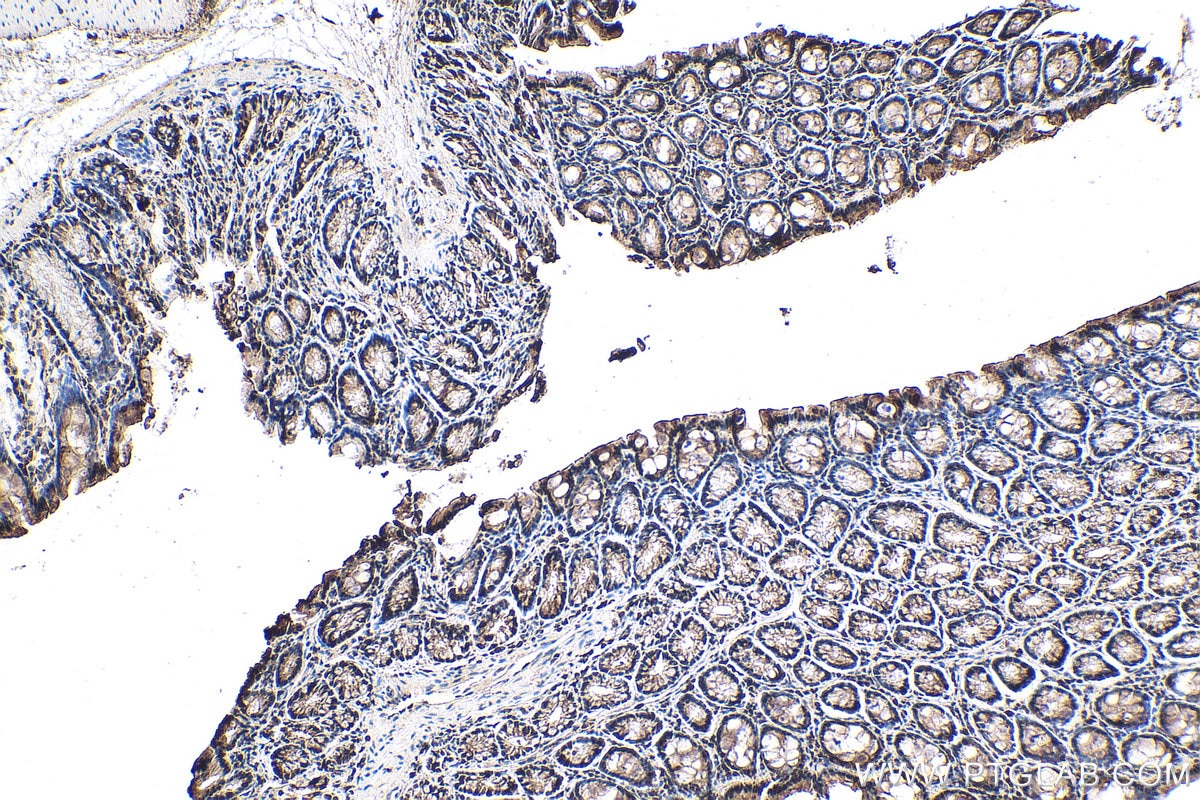 Immunohistochemistry (IHC) staining of rat colon tissue using NRAS-Specific Polyclonal antibody (18296-1-AP)