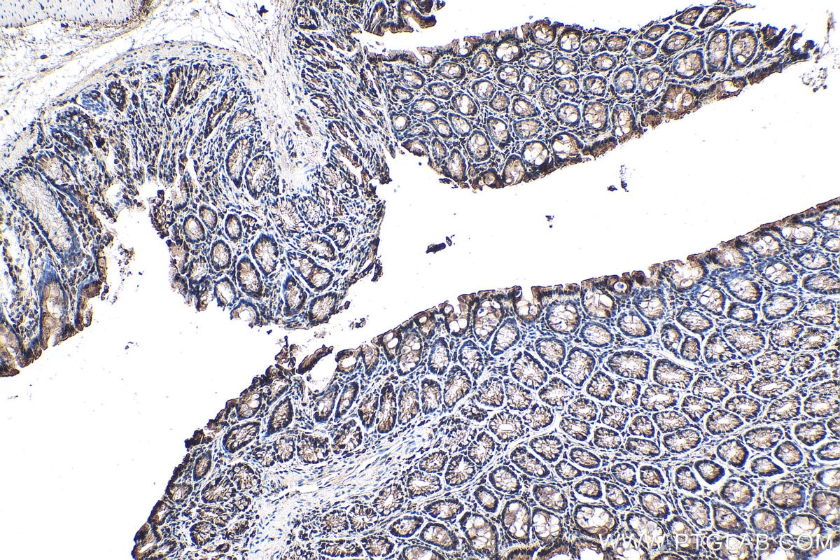 IHC staining of rat colon using 18296-1-AP