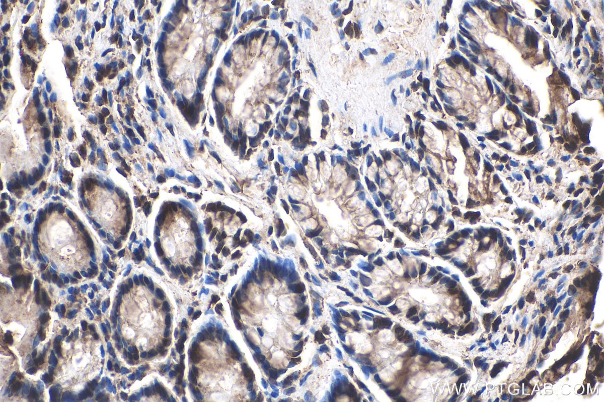Immunohistochemistry (IHC) staining of rat colon tissue using NRAS-Specific Polyclonal antibody (18296-1-AP)