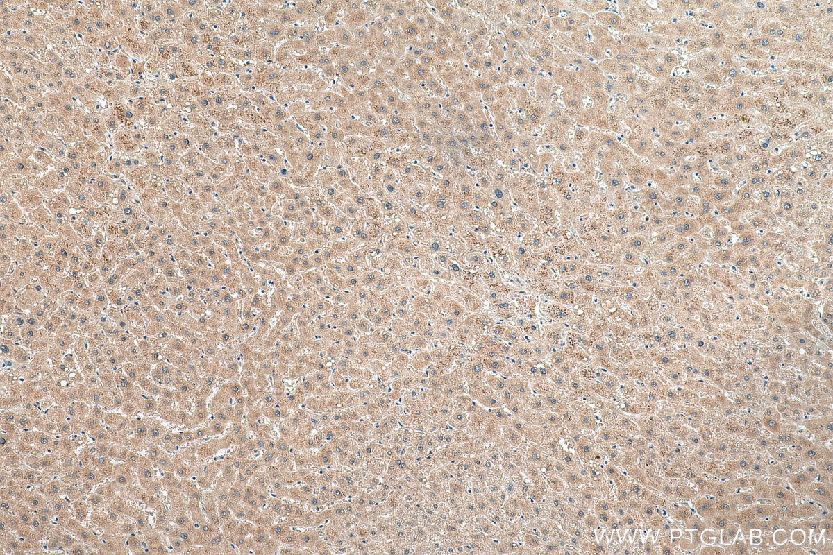 Immunohistochemistry (IHC) staining of human liver tissue using NRBF2 Polyclonal antibody (24858-1-AP)