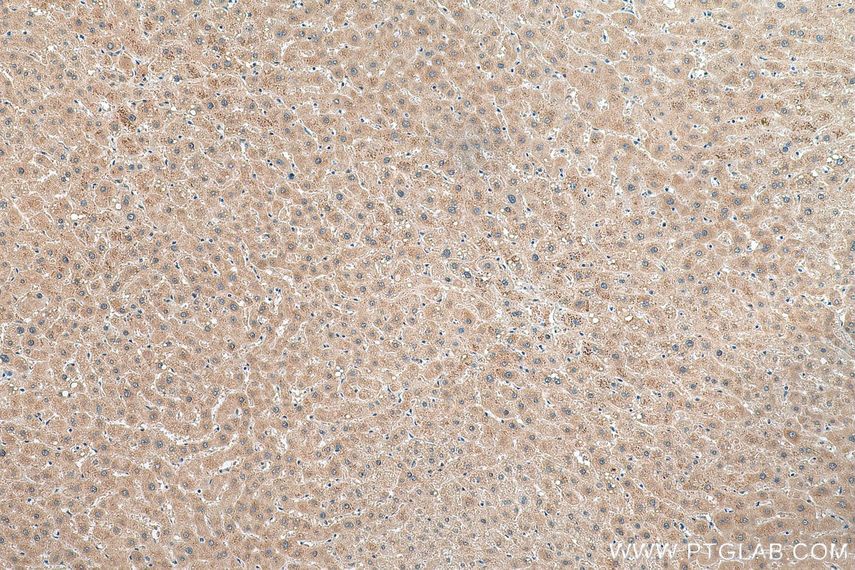 IHC staining of human liver using 24858-1-AP