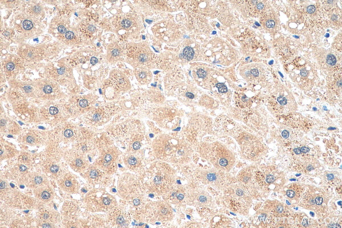 Immunohistochemistry (IHC) staining of human liver tissue using NRBF2 Polyclonal antibody (24858-1-AP)