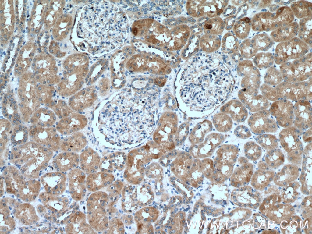 Immunohistochemistry (IHC) staining of human kidney tissue using NRBP2 Polyclonal antibody (21549-1-AP)