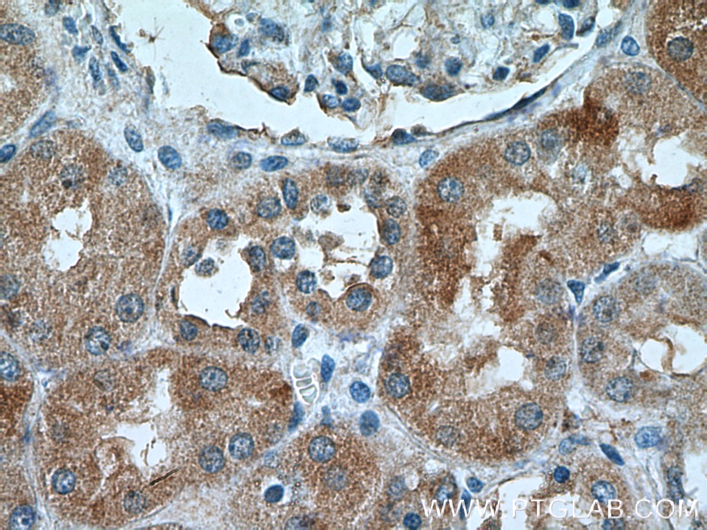 Immunohistochemistry (IHC) staining of human kidney tissue using NRBP2 Polyclonal antibody (21549-1-AP)