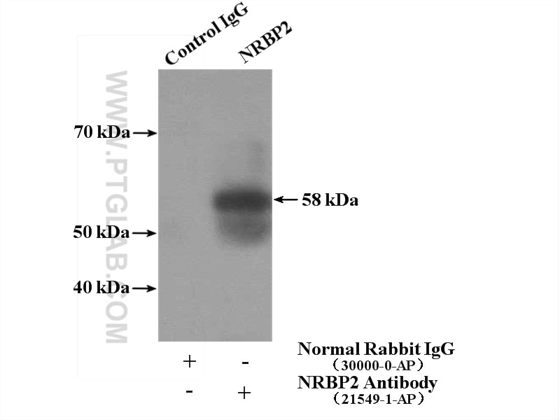 Immunoprecipitation (IP) experiment of mouse kidney tissue using NRBP2 Polyclonal antibody (21549-1-AP)