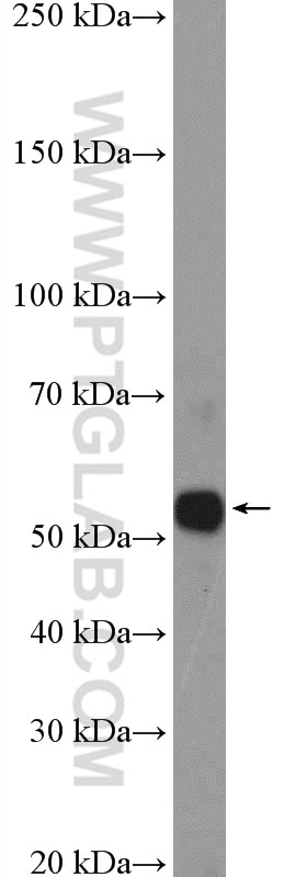 Western Blot (WB) analysis of A549 cells using NRBP2 Polyclonal antibody (21549-1-AP)