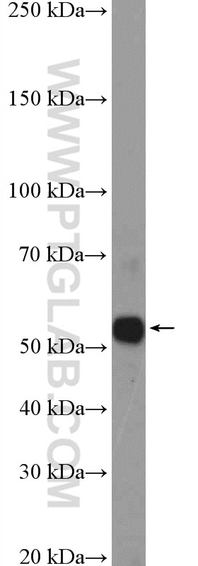 WB analysis of A549 using 21549-1-AP