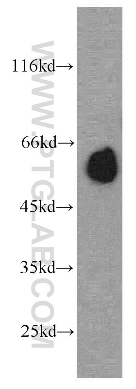 Western Blot (WB) analysis of mouse brain tissue using NRBP2 Polyclonal antibody (21549-1-AP)