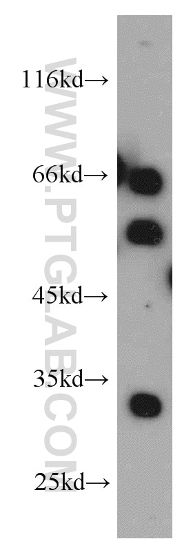 Western Blot (WB) analysis of HeLa cells using NRBP2 Polyclonal antibody (21549-1-AP)