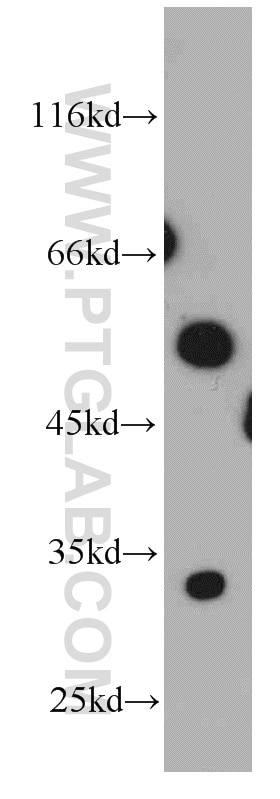 Western Blot (WB) analysis of mouse kidney tissue using NRBP2 Polyclonal antibody (21549-1-AP)