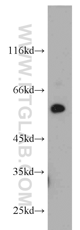 Western Blot (WB) analysis of human testis tissue using NRBP2 Polyclonal antibody (21549-1-AP)