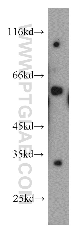 Western Blot (WB) analysis of human placenta tissue using NRBP2 Polyclonal antibody (21549-1-AP)