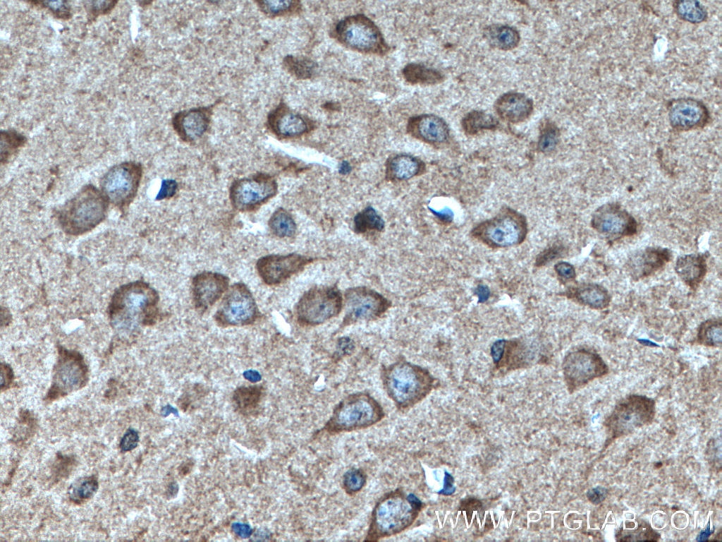 Immunohistochemistry (IHC) staining of mouse brain tissue using NRBP2 Monoclonal antibody (66687-1-Ig)