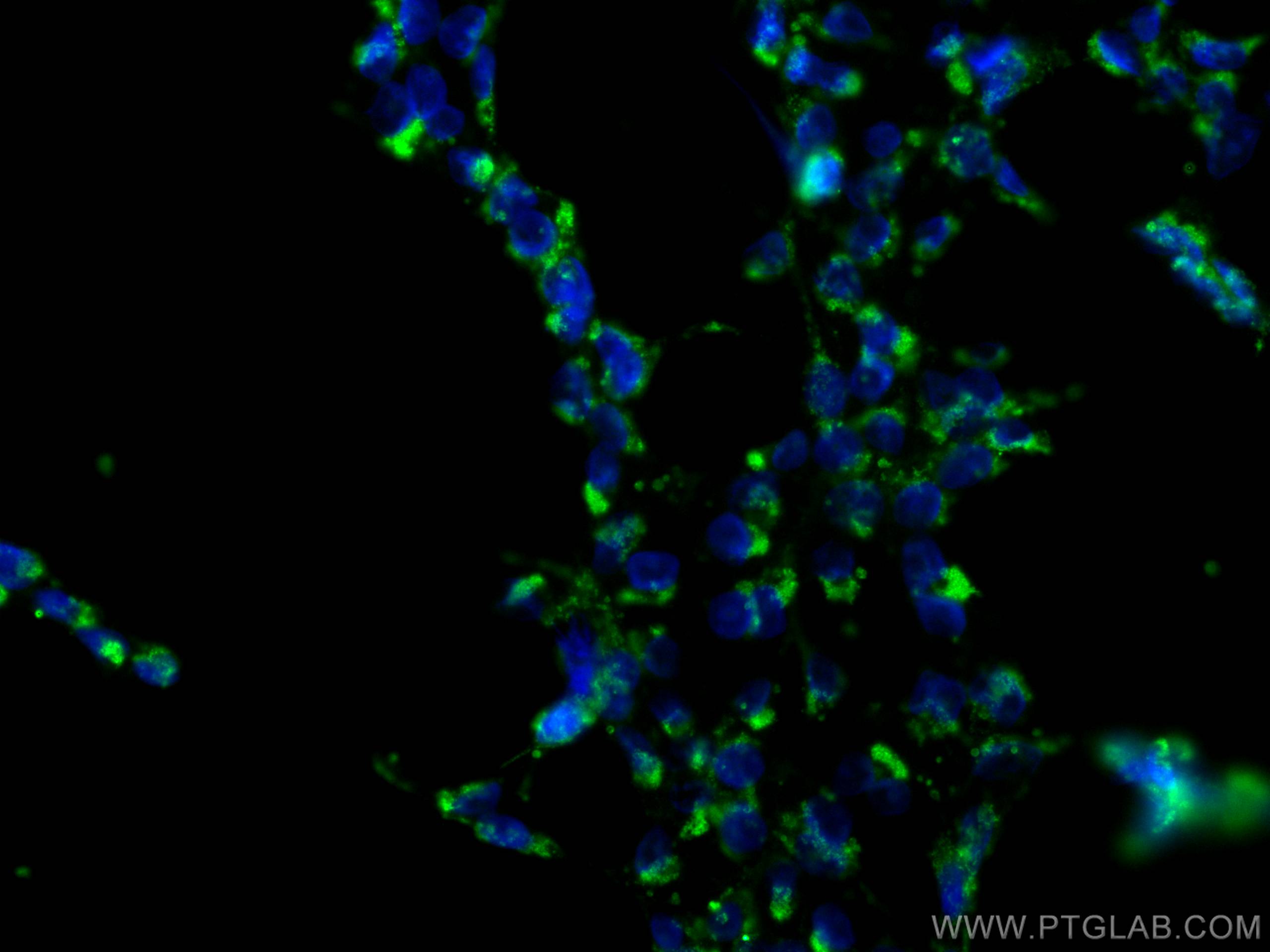 Immunofluorescence (IF) / fluorescent staining of HEK-293 cells using CoraLite® Plus 488-conjugated NRBP2 Monoclonal ant (CL488-66687)