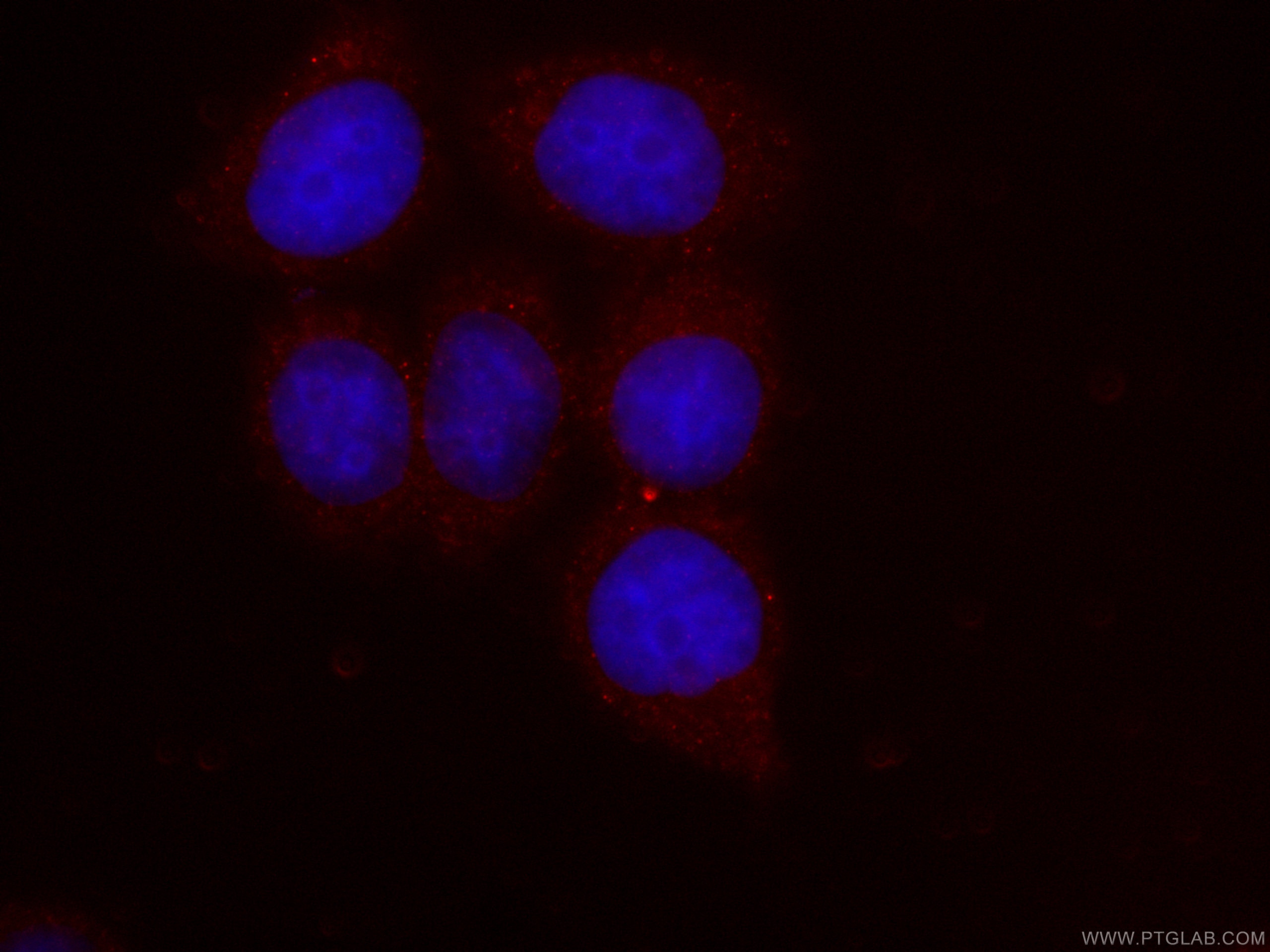 IF Staining of HeLa using CL594-66687