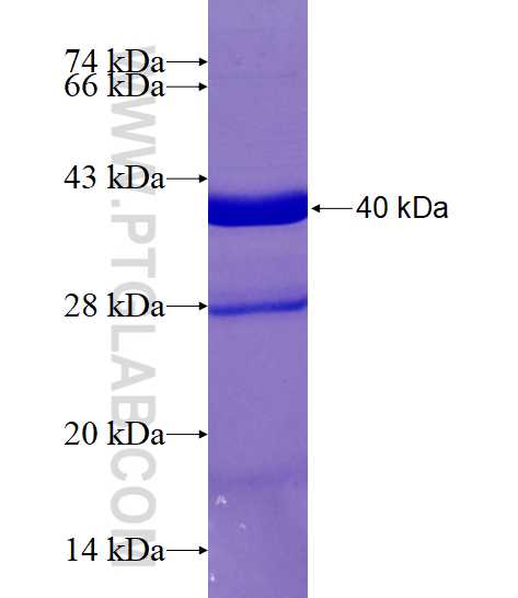 NRBP2 fusion protein Ag16215 SDS-PAGE