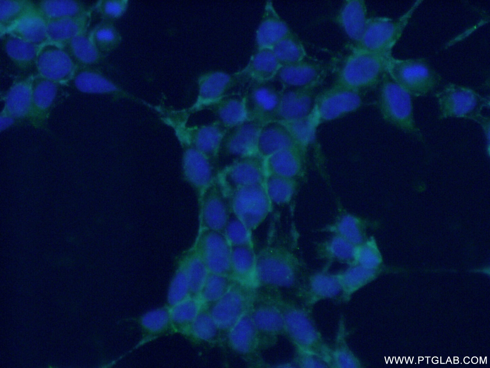 Immunofluorescence (IF) / fluorescent staining of HEK-293 cells using NRCAM Polyclonal antibody (21608-1-AP)