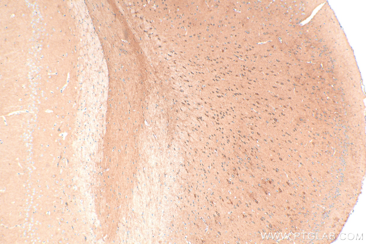 Immunohistochemistry (IHC) staining of mouse brain tissue using NRCAM Polyclonal antibody (21608-1-AP)