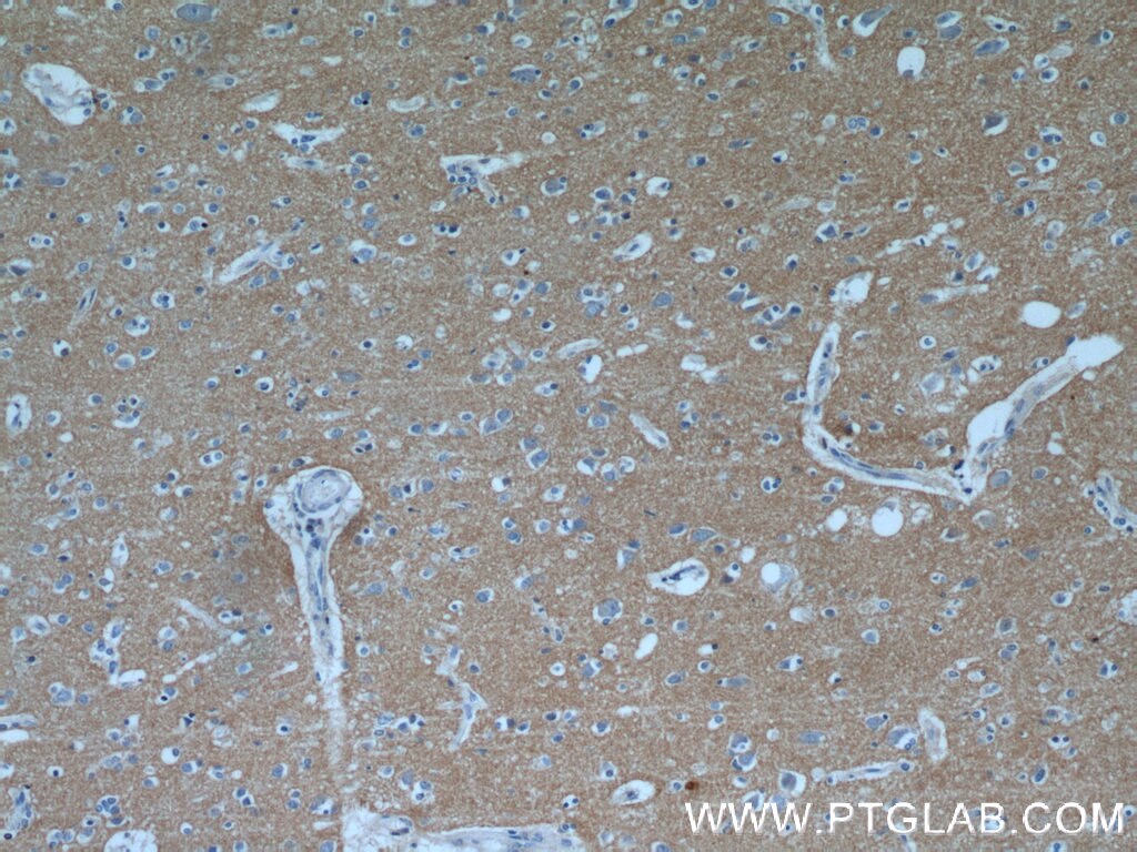 Immunohistochemistry (IHC) staining of human brain tissue using NRCAM Polyclonal antibody (21608-1-AP)