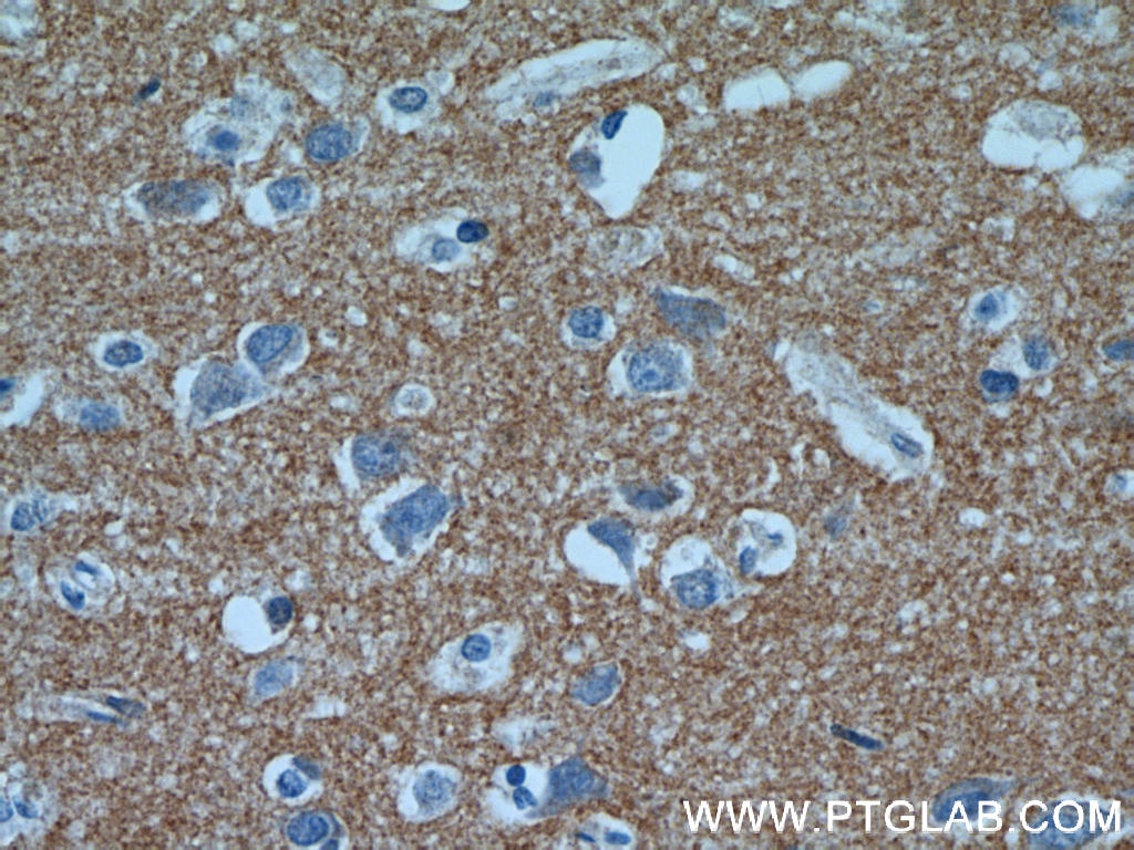 Immunohistochemistry (IHC) staining of human brain tissue using NRCAM Polyclonal antibody (21608-1-AP)