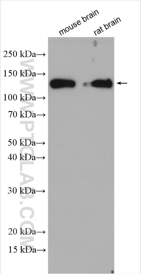 Western Blot (WB) analysis of various lysates using NRCAM Polyclonal antibody (21608-1-AP)